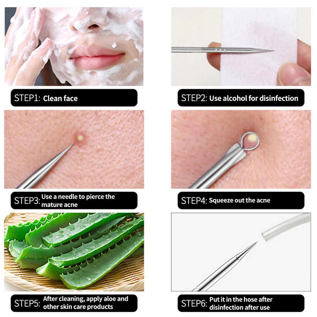 4pc Pimple Remover for face